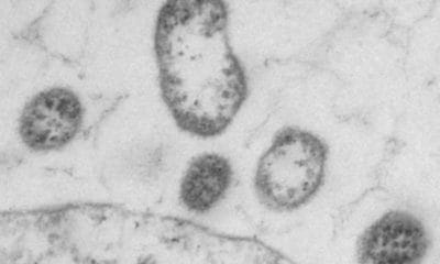 virus